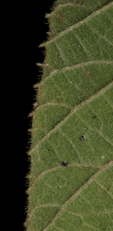 Buchnerodendron speciosum Leaf margin, lower surface.