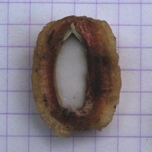 Irvingia smithii Ripe fruits.